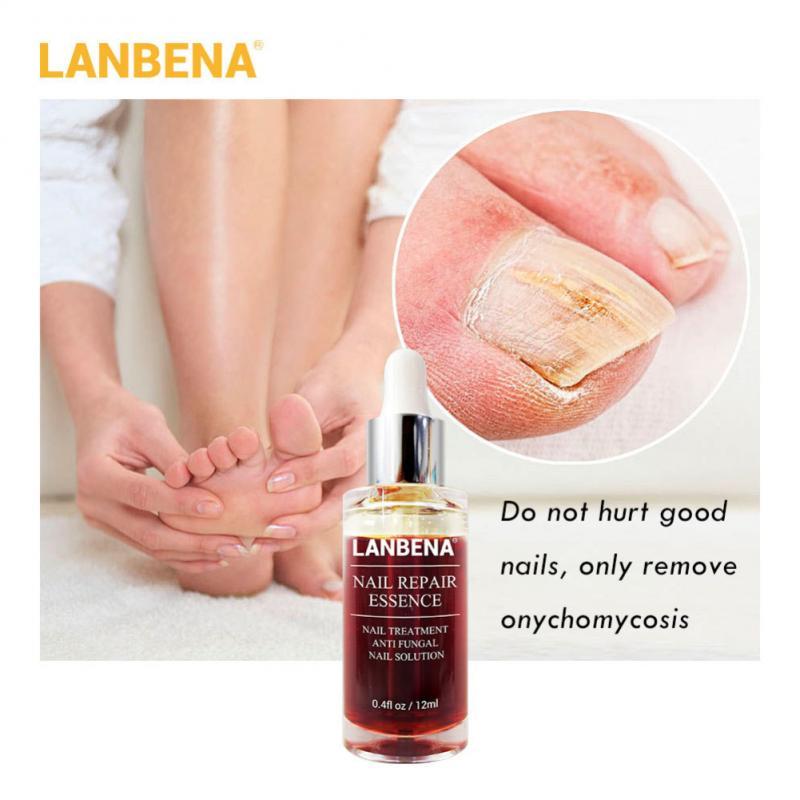 Upgraded Version LANBENA Nail Repair Liquid Treatment With File Nail Anti Remove Nail Onychomycosis Fungus Toe Nail Care TSLM1|Nail Treatments