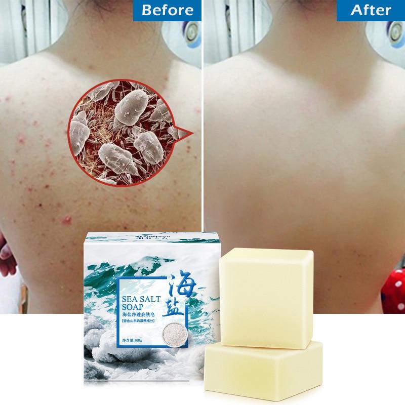 100g Removal Pimple Pore Acne Treatment Sea Salt Soap Cleaner Moisturizing Goat Milk Soap Face Care Wash Basis Soap TSLM1|Soap