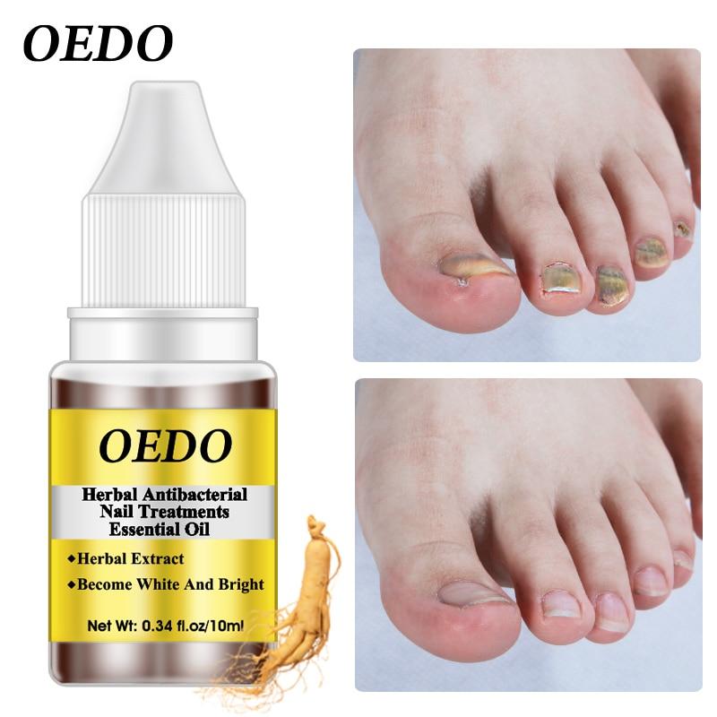 Herbal Antibacterial Nail Treatments Essential Oil Herbal Extract Nail Fungus Art Repair Tools Foot Nail Care Repair Serum|Nail Treatments