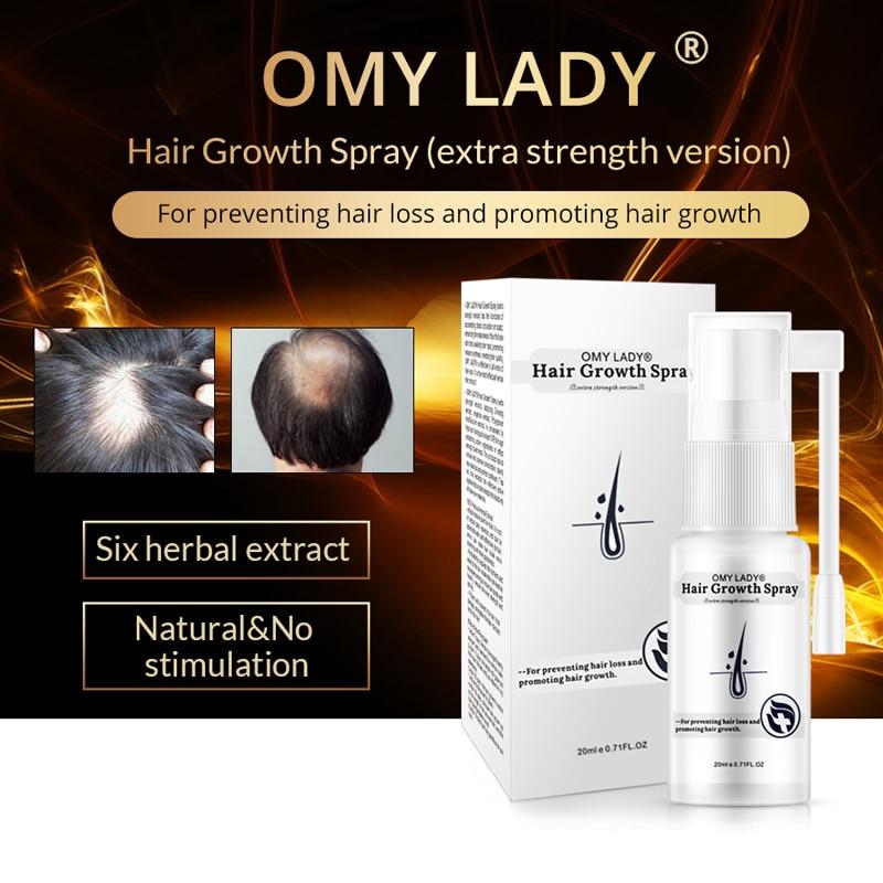 OMY LADY Anti Hair Loss Hair Growth Spray Essential Oil Liquid For Men Women Dry Hair Regeneration Repair Hair Loss Products|Hair Loss Products