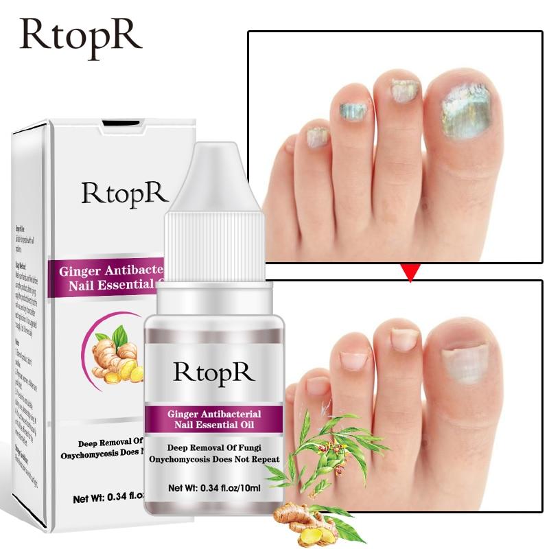 2 pcs - 10ml Professional Fungal Nail Treatment Essence Nail Foot Whitening Toe Fungus Removal Feet Care Nail Gel For Onychomy Nail Care|Nail Treatments