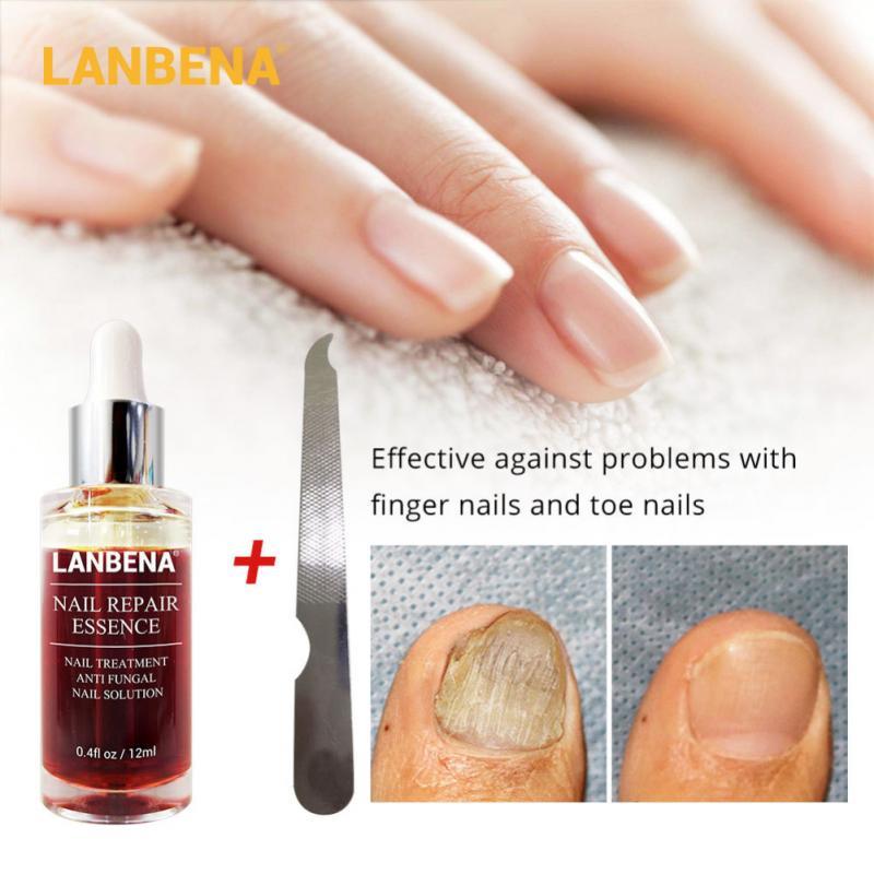 LANBENA Liquid Fungal Nail Repair Treatment With File Anti Fungus Nail Toe Repair Serum Nourishing Nail Care Essence TSLM1|Nail Treatments