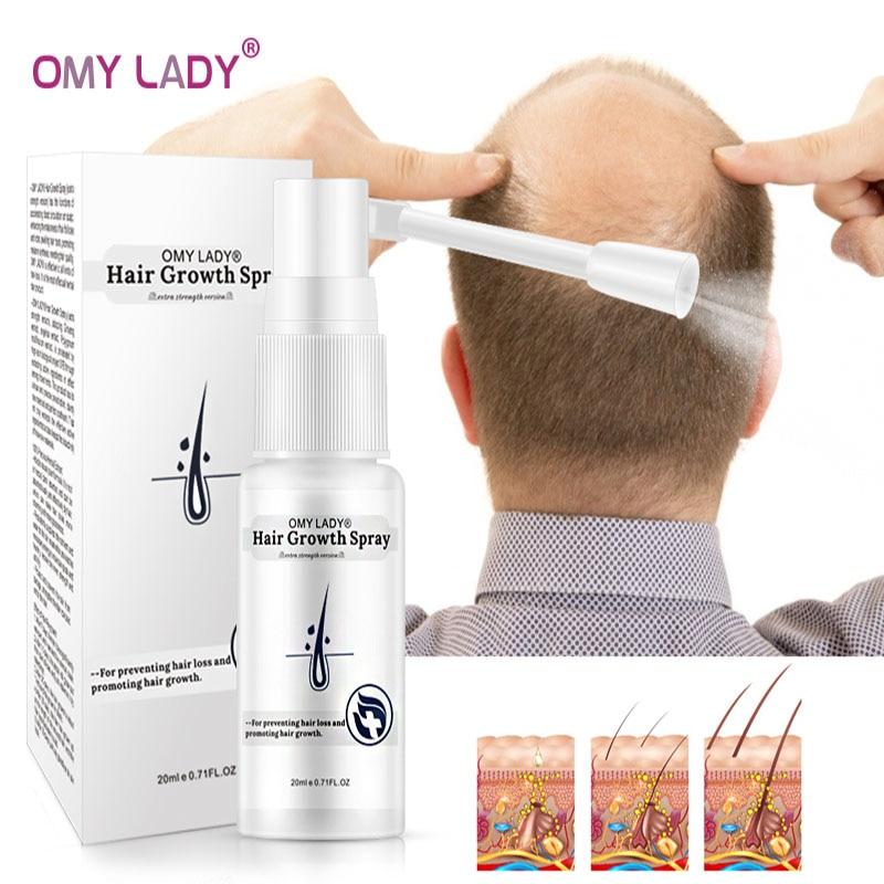 OMY LADY Anti Hair Loss Hair Growth Spray Essential Oil Liquid For Men Women Dry Hair Regeneration Repair Hair Loss Products|Hair Loss Products