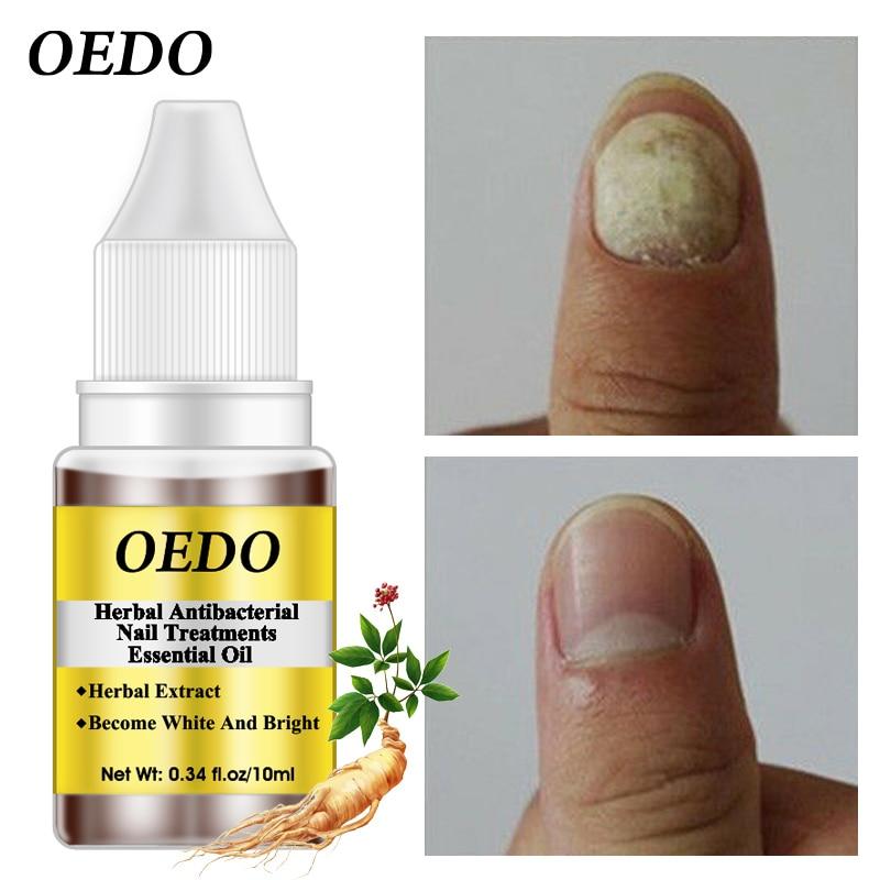 Herbal Antibacterial Nail Treatments Essential Oil Herbal Extract Nail Fungus Art Repair Tools Foot Nail Care Repair Serum|Nail Treatments