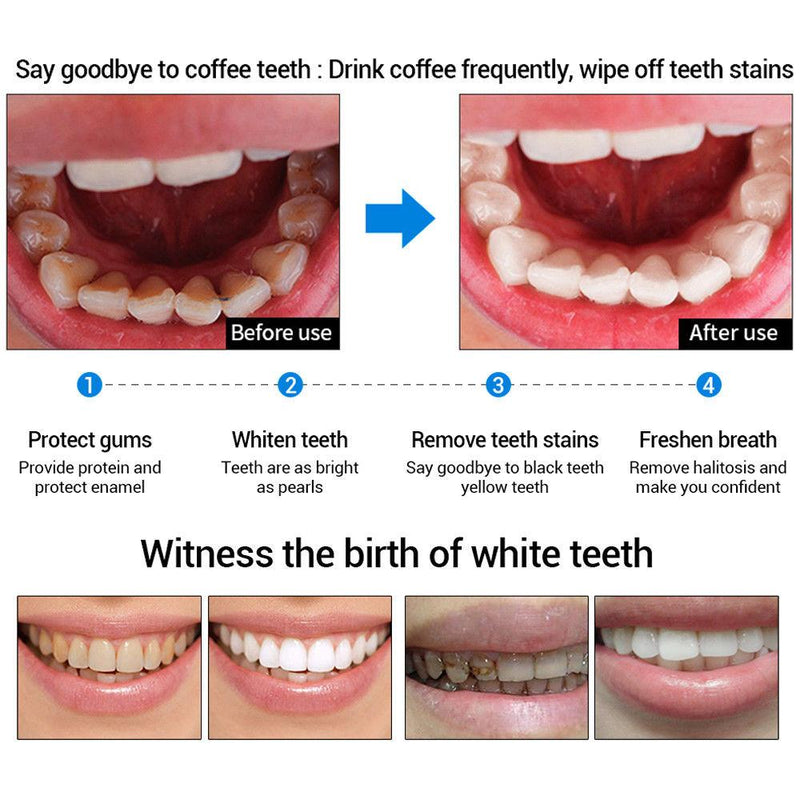 Hot LANBENA Teeth Whitening Essence Liquid Oral Hygiene Cleaning Remove Plaque Stain Brighten Tooth Whitening Oral Hygiene TSLM1|Teeth Whitening