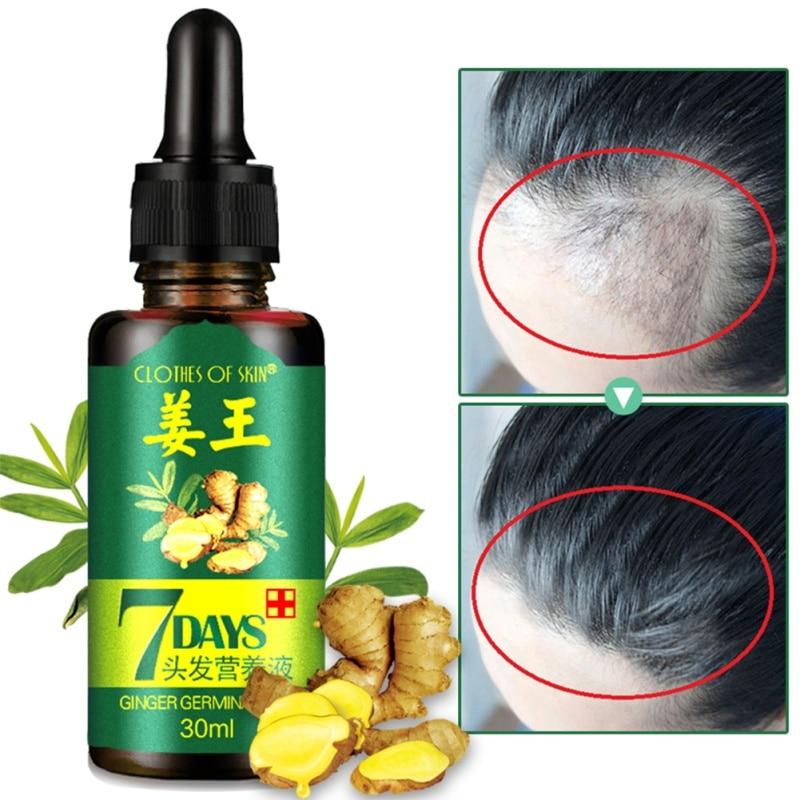 2/3/4pcs 7 Days Ginger Hair Growth Oil Essence Hairdressing Hairs Mask Serum Dry and Damaged Hairs 30 ml Deeply Nutrition Care|Hair & Scalp Treatments