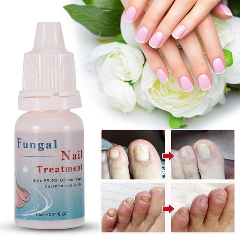 Firstsun 10ML Herbs Fungal Nail Treatment Toe Nail Fungus Removal Gel Moisturizing Nail Gel for Onychomycosis TSLM2|Nail Treatments