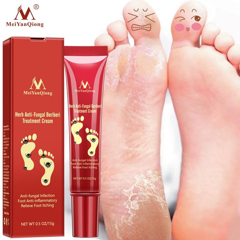 Foot Care Cream Foot spa Pedicure Herbal Detox Anti Fungal Infection Onychomycosis Fungus Treatment For legs|Feet