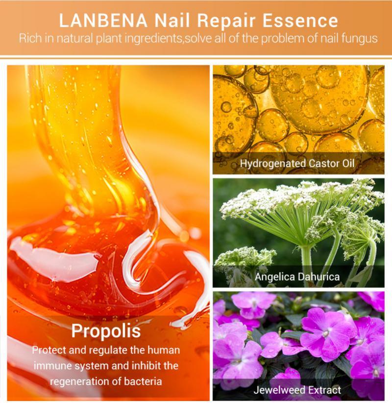 LANBENA Fungal Nail Repair Essence Serum Care Treatment Foot Nail Fungus Removal Gel Anti Paronychia Onychomycosis|Nail Treatments