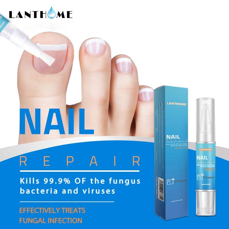 Powerful Nail Treatment Pen Onychomycosis Paronychia Anti Fungal Nail Infection Chinese Herbal Toe Fungus Care Repair Serum MS01|Nail Treatments