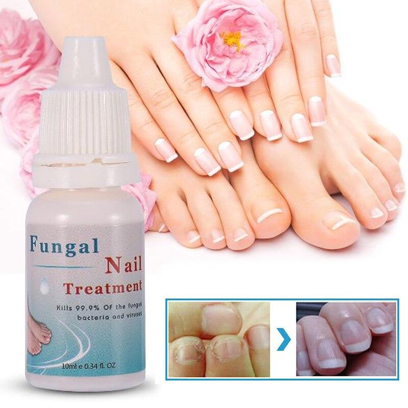 Firstsun 10ML Herbs Fungal Nail Treatment Toe Nail Fungus Removal Gel Moisturizing Nail Gel for Onychomycosis TSLM2|Nail Treatments