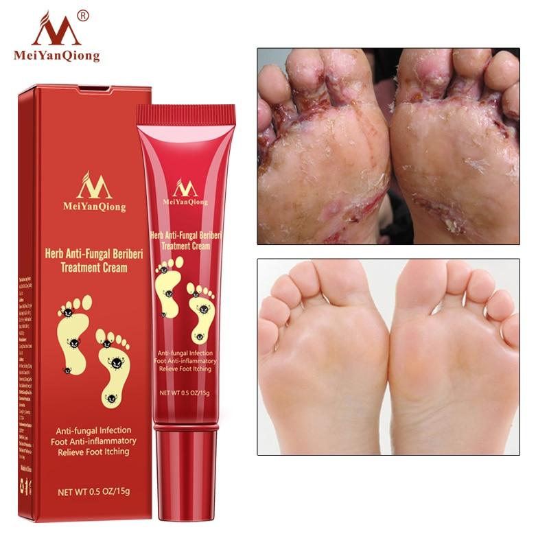 Foot Care Cream Foot spa Pedicure Herbal Detox Anti Fungal Infection Onychomycosis Fungus Treatment For legs|Feet