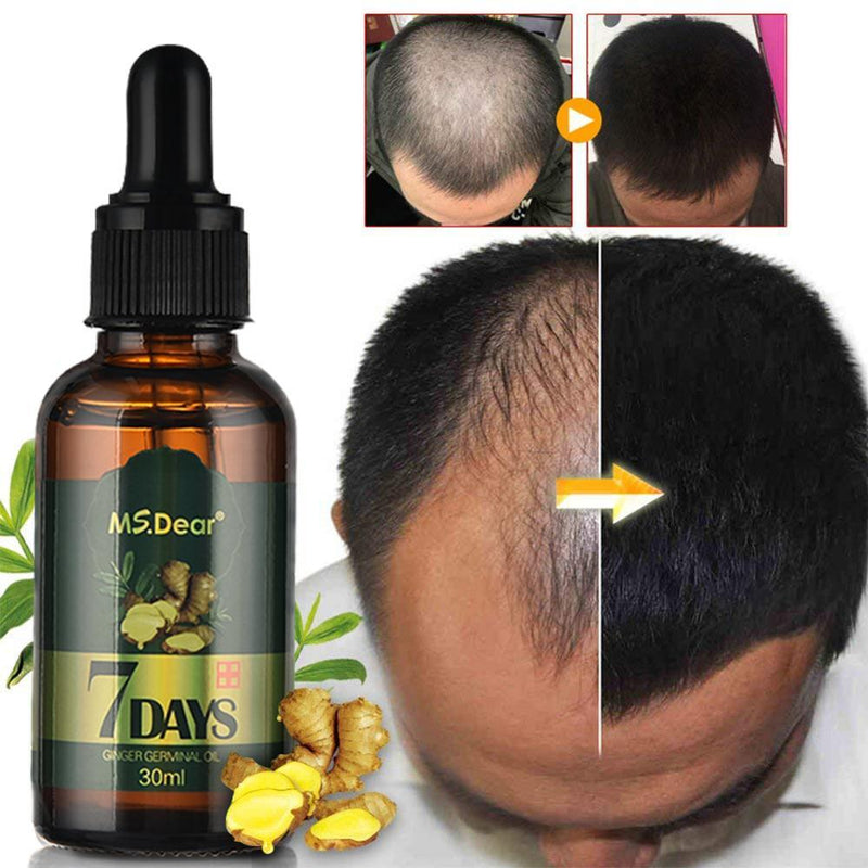 Hair Growth Essential Oils Ginger Germinal Oil Fast Hair Growth Anti Hair Loss Alopecia Treatment Beauty Dense Hair Growth Serum|Hair Loss Products