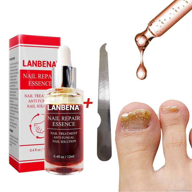 LANBENA Nail Repair Liquid Treatment with File Nail Anti Remove Nail Onychomycosis Fungus Toe Nourishing Brighten Nail TSLM1|Nail Treatments