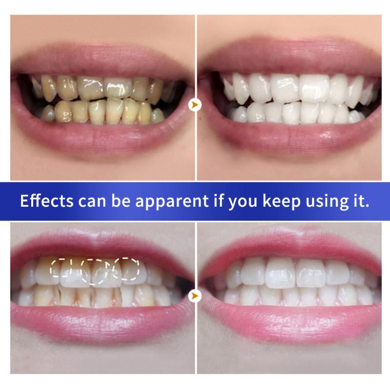 BREYLEE Teeth Whitening Powder Toothpaste Dental Teeth Cleaning Oral Hygiene Remove Plaque Tooth Whiten Brighten Powder TSLM1|Teeth Whitening