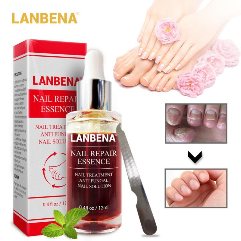 LANBENA Liquid Fungal Nail Repair Treatment With File Anti Fungus Nail Toe Repair Serum Nourishing Nail Care Essence TSLM1|Nail Treatments