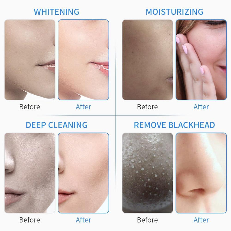 6 In 1 Water Oxygen Jet Aqua Peeling Hydra Beauty Facial Skin Deep Cleansing Machine Professional Hydro Dermabrasion SPA Salon|Microdermabrasion Peel Machine