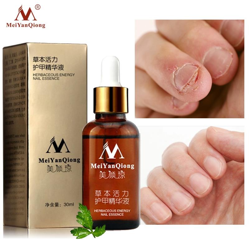 MeiYanQiong Fungal Nail Treatment Feet Care Essence Nail Foot Whitening Toe Nail Fungus Removal Gel Anti Infection Paronychia|Nail Treatments