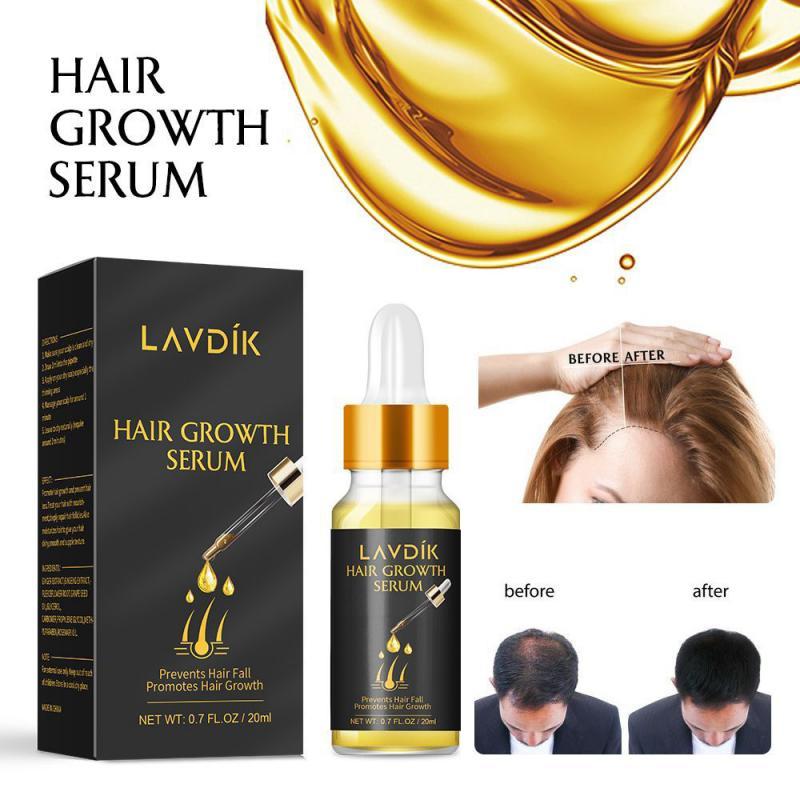 20ml Ginger Fast Hair Growth Serum Essential Oil Anti Preventing Hair Lose Liquid Damaged Hair Repair Growing Women Men TXTB1|Men's Hair Loss Products