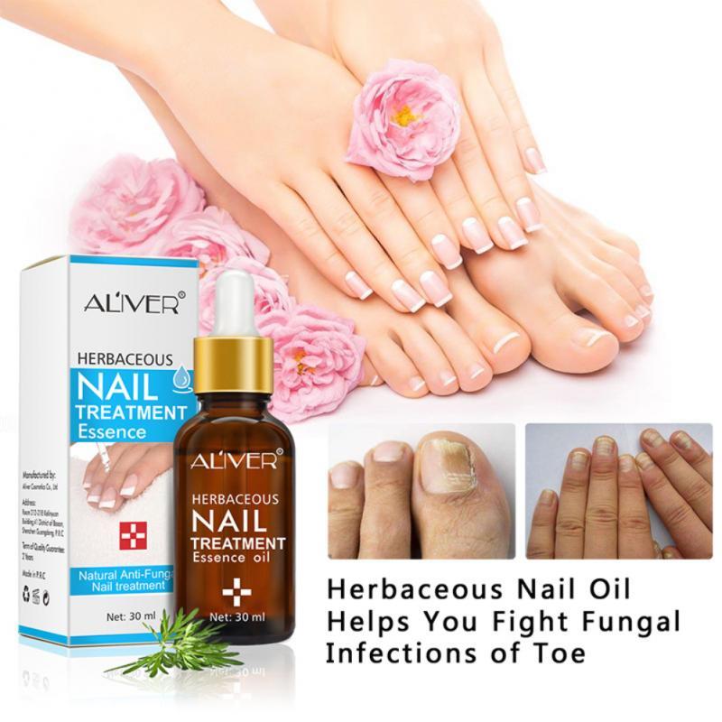 LANBENA Fungal Nail Repair Essence Serum Care Treatment Foot Nail Fungus Removal Gel Anti Paronychia Onychomycosis|Nail Treatments