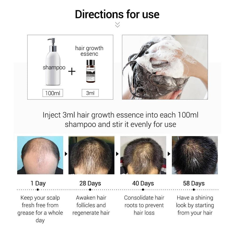 LANBENA Fast Powerful Hair Growth Essence Products Essential Oil Liquid Treatment Preventing Hair Loss Hair Care Andrea MSLQ01|Hair Loss Products