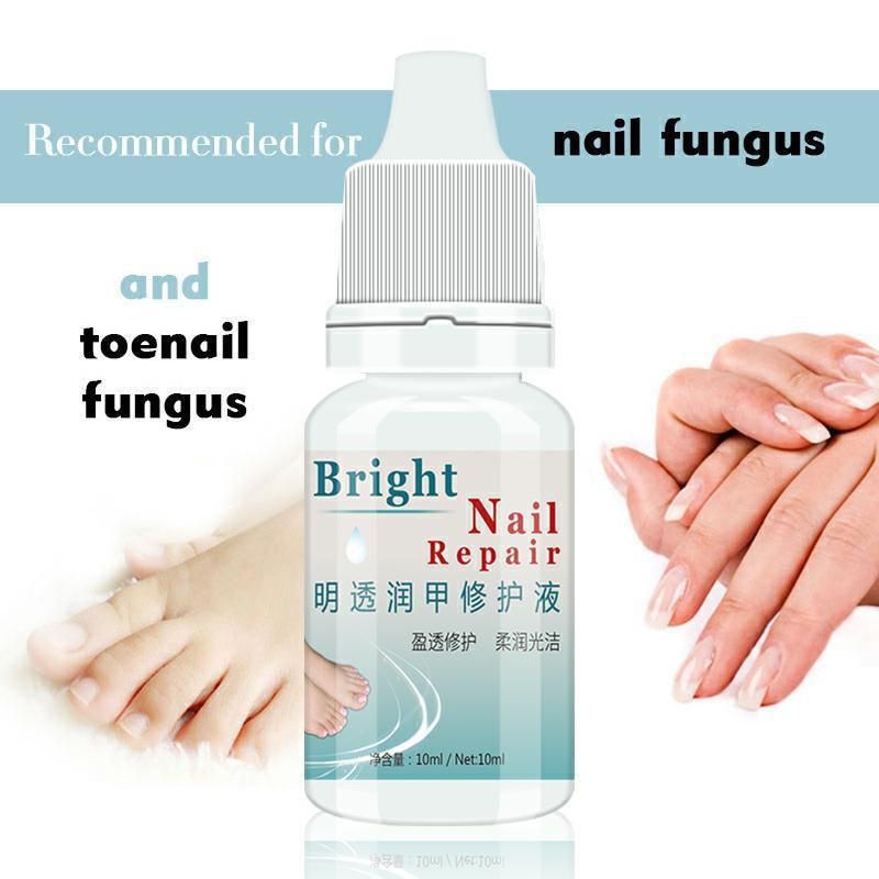 Firstsun 10ML Herbs Fungal Nail Treatment Toe Nail Fungus Removal Gel Moisturizing Nail Gel for Onychomycosis TSLM2|Nail Treatments