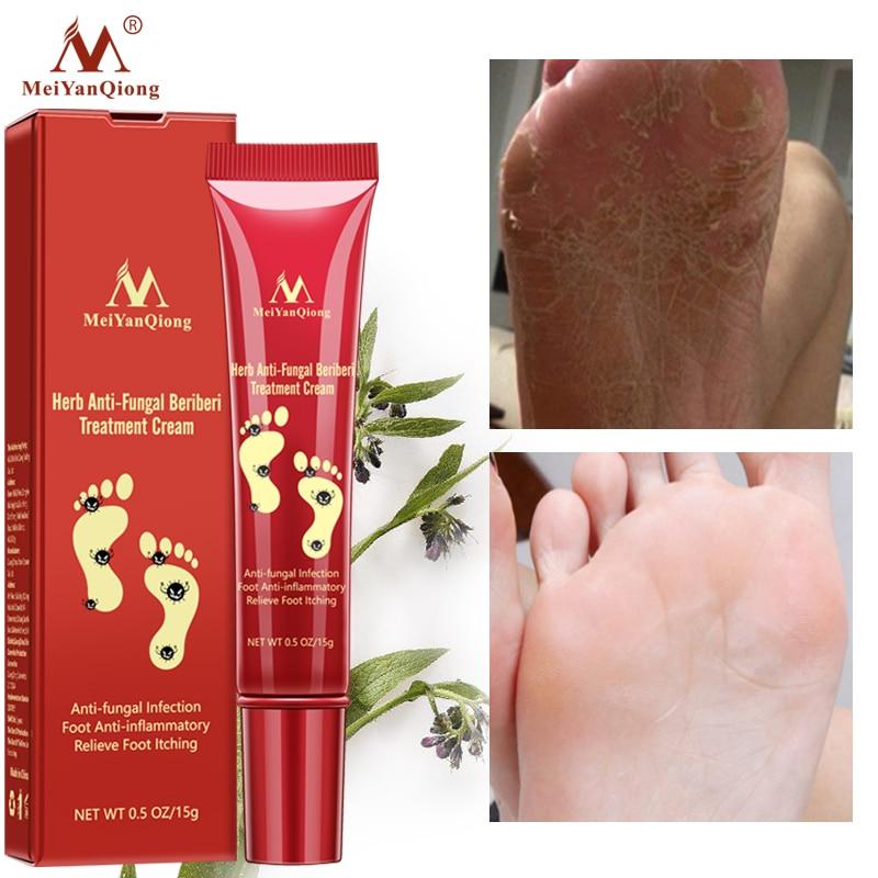 Foot Care Cream Foot spa Pedicure Herbal Detox Anti Fungal Infection Onychomycosis Fungus Treatment For legs|Feet