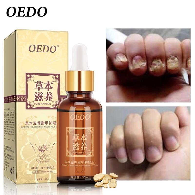 Herbal Fungal Nail Treatment Essential oil Hand and Foot Whitening Toe Nail Fungus Removal Infection Feet Care Polish Nail Gel|nail treatment|foot nailgel gel