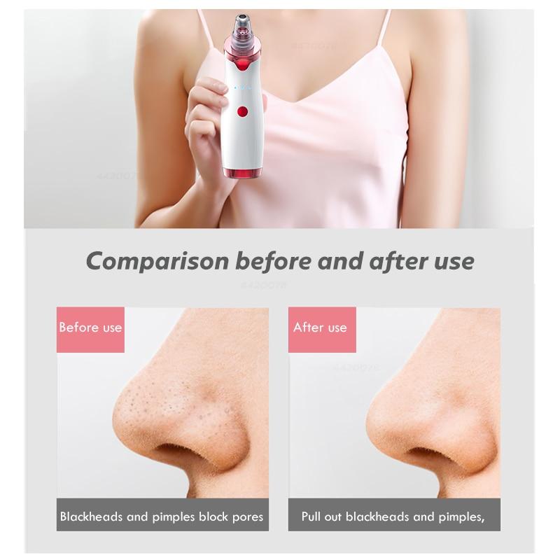 Blackhead Remover Face Deep Nose Cleaner T Zone Pore Acne Pimple Removal Vacuum Suction Facial Diamond Beauty Clean Skin Tool|Home Use Beauty Devices