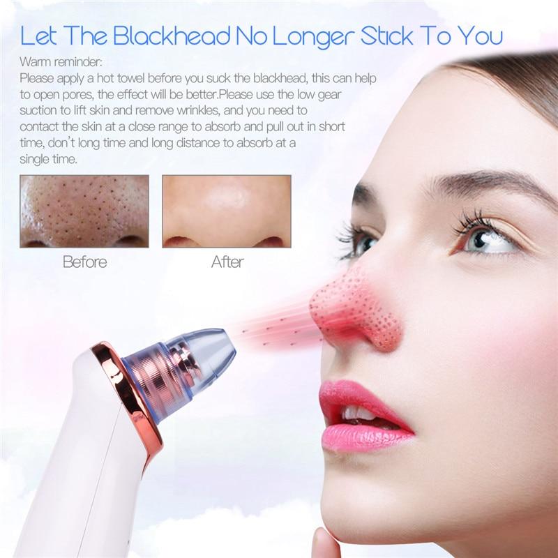 Blackhead Remover Skin Care Pore Vacuum Acne Pimple Removal Vacuum Suction Tool Facial Diamond Dermabrasion Machine Face Clean46|Home Use Beauty Devices