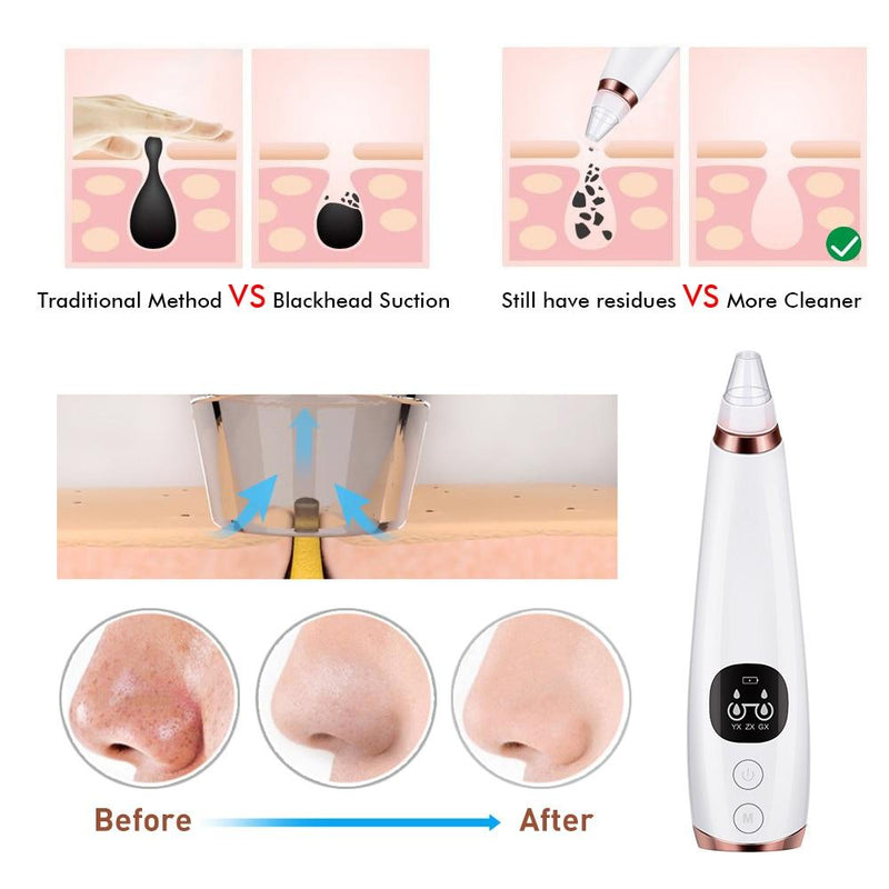 Blackhead Remover Vacuum Pore Cleaner Electric Nose Face Deep Cleansing Skin Care Machine Birthday Gift Dropshipping Beauty Tool|Home Use Beauty Devices