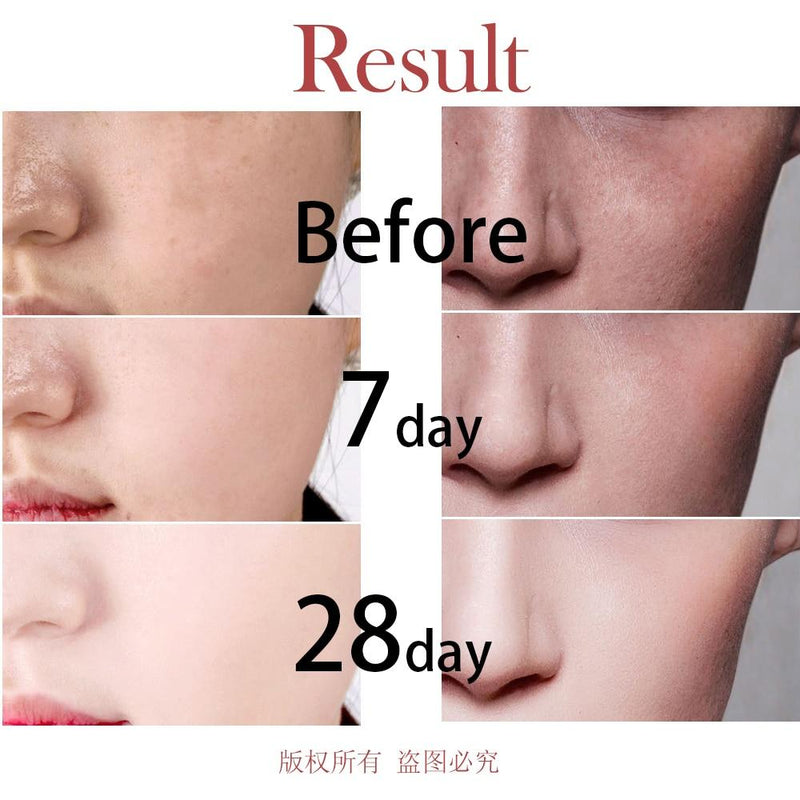 Fonce Arbutin Whitening Skin Facial Essence 28 Bottle Small Ampoule Niacinamide Revitalizing Brightening Beauty Needle Serum|Serum