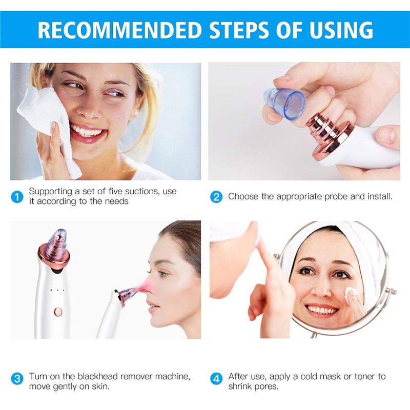 Microdermabrasion Blackhead Remover Vacuum Suction Face Pimple Acne Comedone Extractor Facial Pores Cleaner Skin Care Tools 38|Home Use Beauty Devices