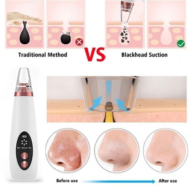 Pore Cleaner Blackhead Remover Vacuum Face Skin Care Suction Black head Black Dots Blackheads Pimples Removal Deep Cleaning Tool|Home Use Beauty Devices