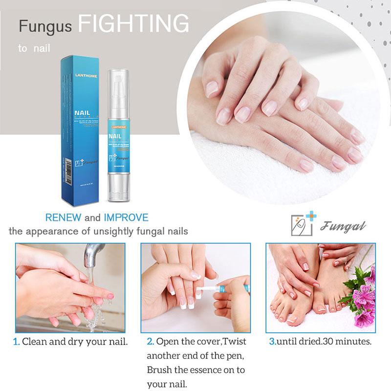 Powerful Nail Treatment Pen Onychomycosis Paronychia Anti Fungal Nail Infection Chinese Herbal Toe Fungus Care Repair Serum MS01|Nail Treatments