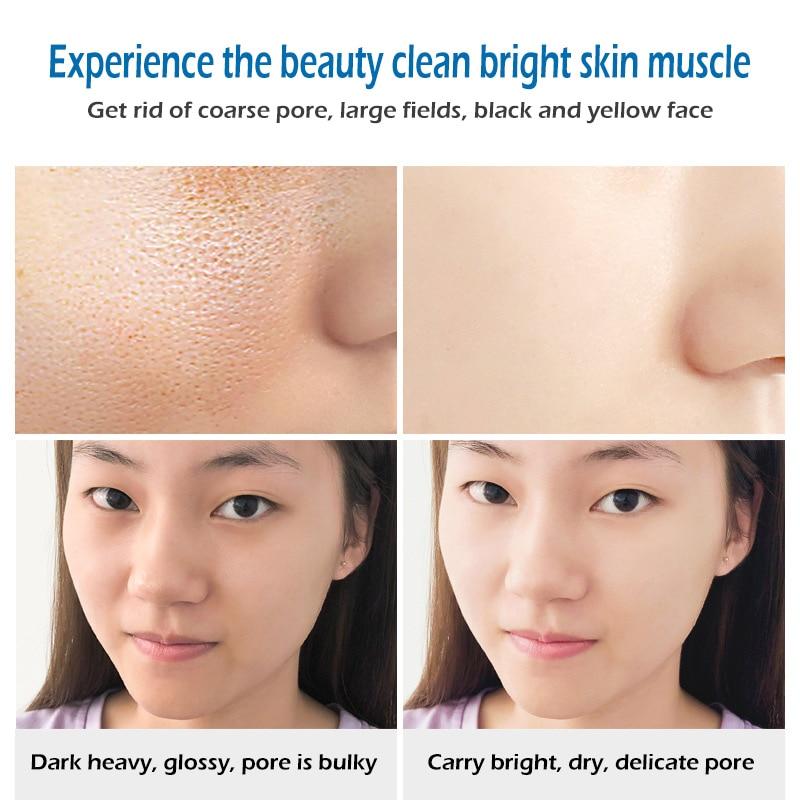 Sea Salt Soap whitening Moisturizing Wash Base Removal Pimple Pores Acne Treatment Face Care Wash Basis Soap Shower TSLM1|Soap