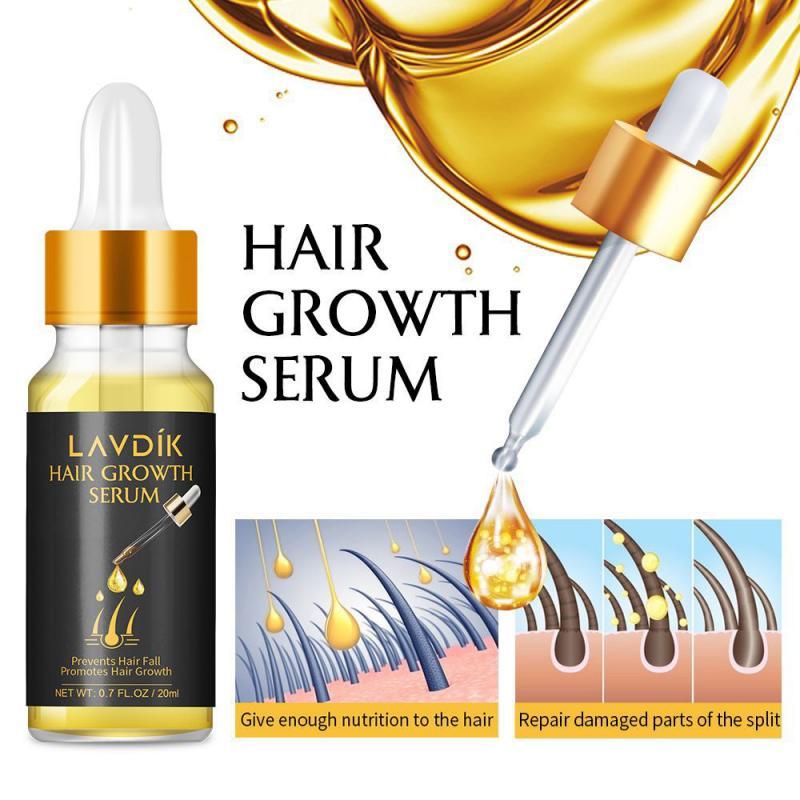 20ml Ginger Fast Hair Growth Serum Essential Oil Anti Preventing Hair Lose Liquid Damaged Hair Repair Growing Women Men TXTB1|Men's Hair Loss Products