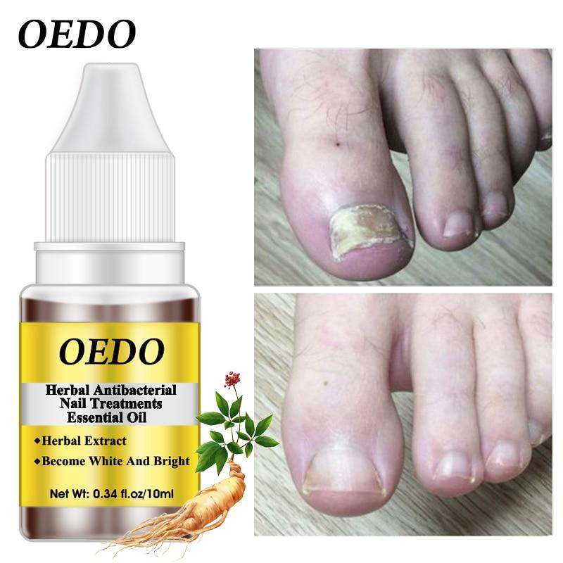 Herbal Antibacterial Nail Treatments Essential Oil Herbal Extract Nail Fungus Art Repair Tools Foot Nail Care Repair Serum|Nail Treatments