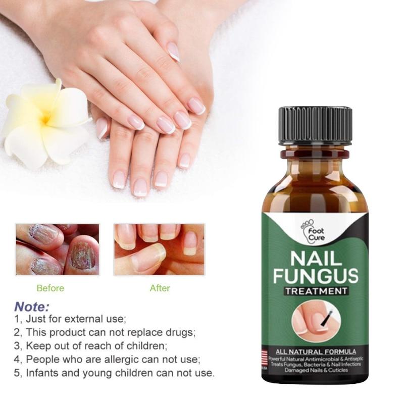 Hand Foot Nail Repair Liquid Hand And Foot Onychomycosis Care Repair Liquid Antifungal Thickening Soft Nail Care Fluid TSLM1|Nail Treatments