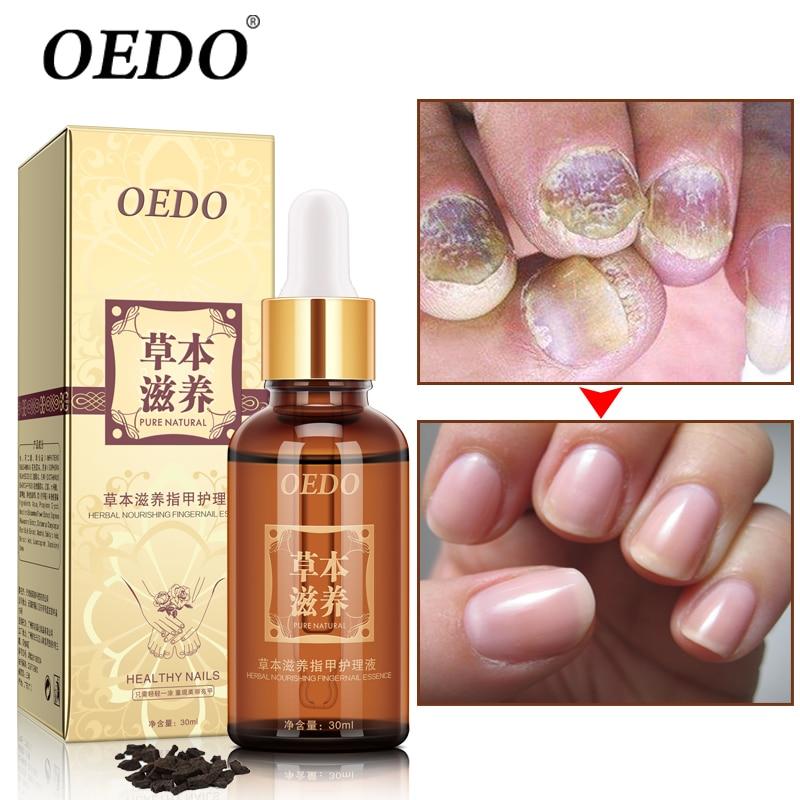 Herbal Fungal Nail Treatment Essential oil Hand and Foot Whitening Toe Nail Fungus Removal Infection Feet Care Polish Nail Gel|nail treatment|foot nailgel gel