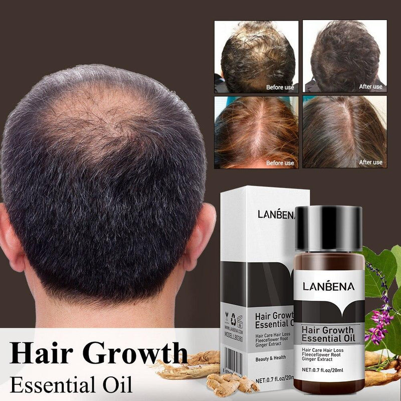 LANBENA Fast Powerful Hair Growth Essence Products Essential Oil Liquid Treatment Preventing Hair Loss Hair Care Andrea MSLQ01|Hair Loss Products