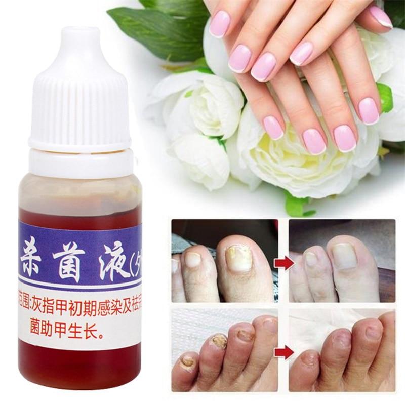 Nail Repair Fungal Nail Treatment Remove Toe Onychomycosis Remover Serum Nail Fungus Repair Treatment for Health Skin Care TSLM1|Nail Treatments