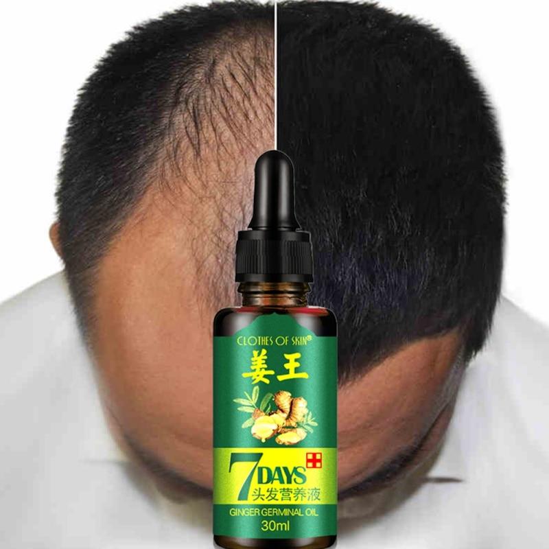 2/3/4pcs 7 Days Ginger Hair Growth Oil Essence Hairdressing Hairs Mask Serum Dry and Damaged Hairs 30 ml Deeply Nutrition Care|Hair & Scalp Treatments