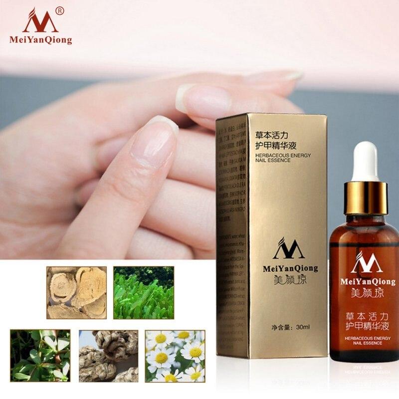 MeiYanQiong Fungal Nail Treatment Feet Care Essence Nail Foot Whitening Toe Nail Fungus Removal Gel Anti Infection Paronychia|Nail Treatments