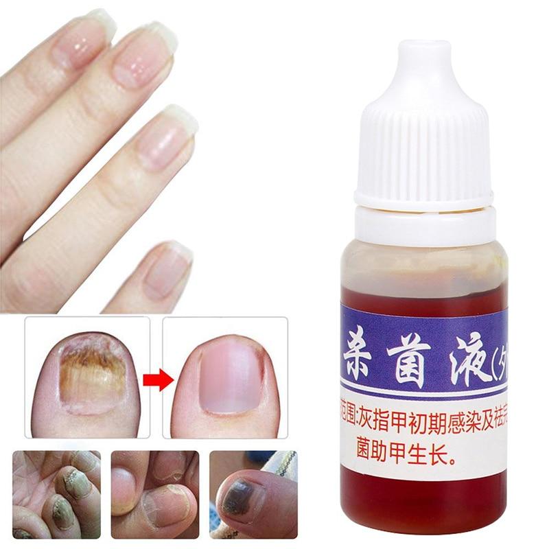 Nail Repair Fungal Nail Treatment Remove Toe Onychomycosis Remover Serum Nail Fungus Repair Treatment for Health Skin Care TSLM1|Nail Treatments