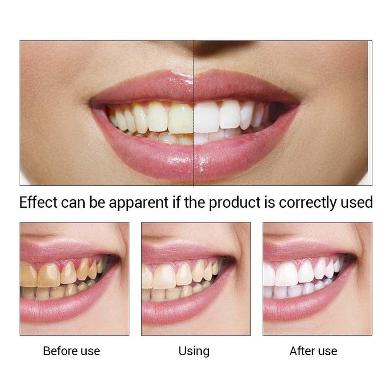 Hot LANBENA Teeth Whitening Essence Liquid Oral Hygiene Cleaning Remove Plaque Stain Brighten Tooth Whitening Oral Hygiene TSLM1|Teeth Whitening