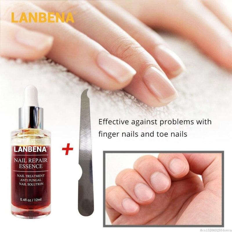 LANBENA Nail Repair Liquid Treatment with File Nail Anti Remove Nail Onychomycosis Fungus Toe Nourishing Brighten Nail TSLM1|Nail Treatments