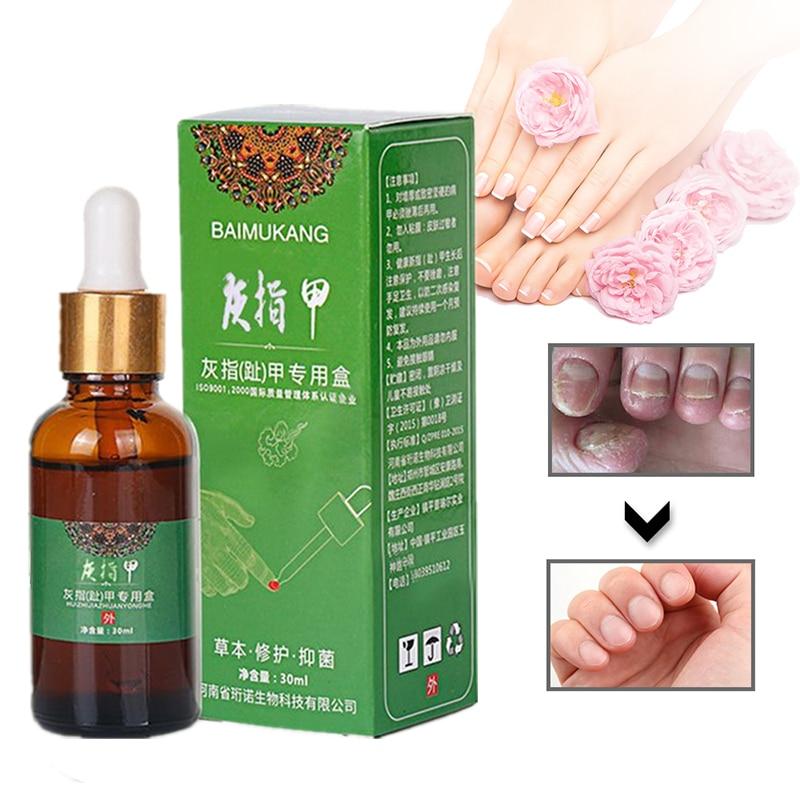 Onychomycosis Nail Repair Promote Regrow Nail Care Nail Essence Anti Infection Paronychia Leuconychia Toe Nails Removal Gel|Nail Treatments