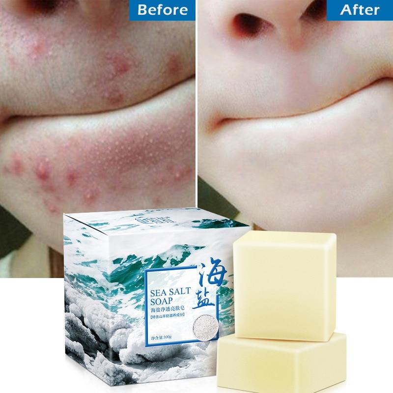 Sea Salt Soap whitening Moisturizing Wash Base Removal Pimple Pores Acne Treatment Face Care Wash Basis Soap Shower TSLM1|Soap