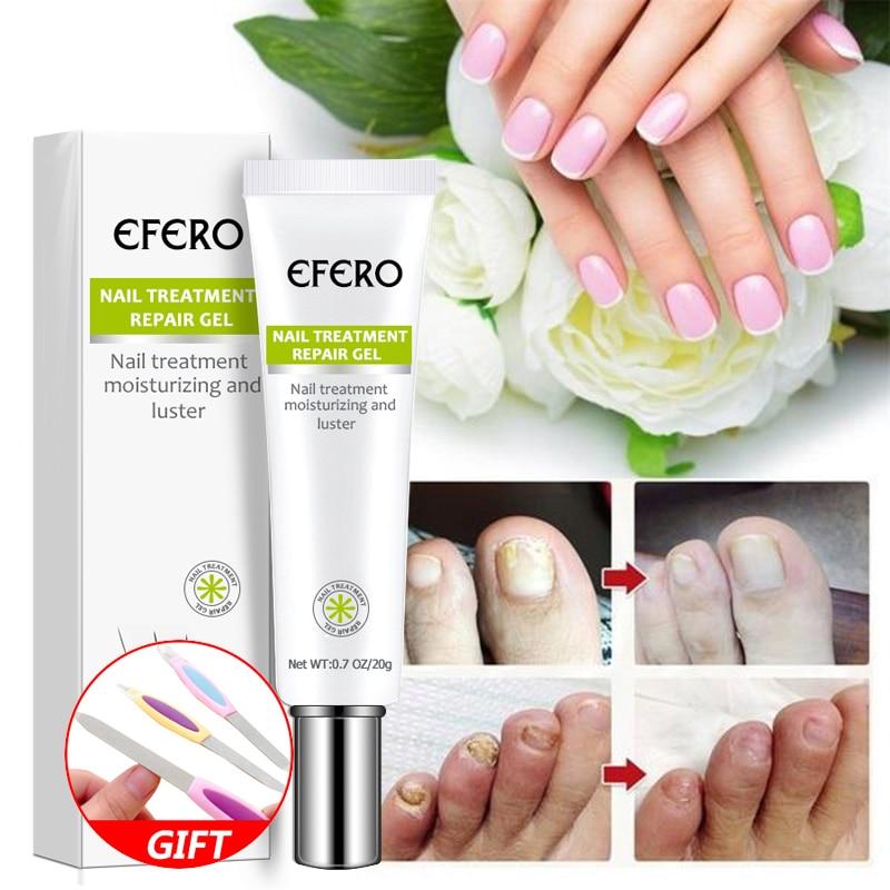 Fungal Nail Treatment Serum Nail Foot Nail Fungus Removal Gel Anti Infection Onychomycosis Nail Repair Essence Cream Feet Care|Nail Treatments